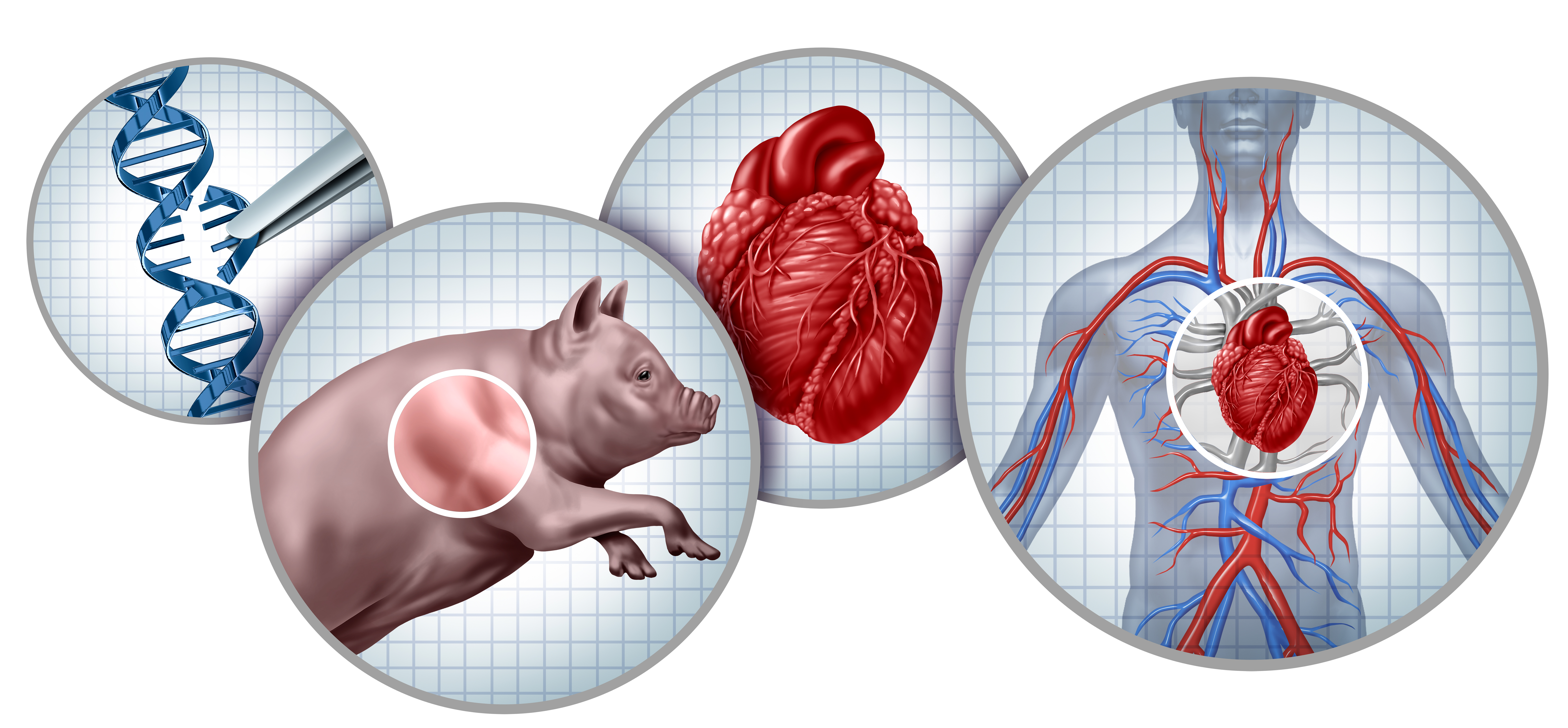 Organ Transplantation & Xenotransplantation